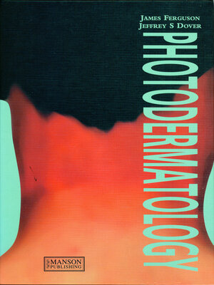 cover image of Photodermatology